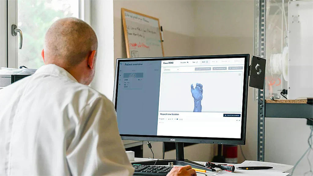 技術者がコンピューター上で手の3Dモデルを確認し、医療用カスタムインプラントの設計と評価を行っています。